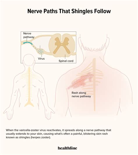 spinal cord and shingles.